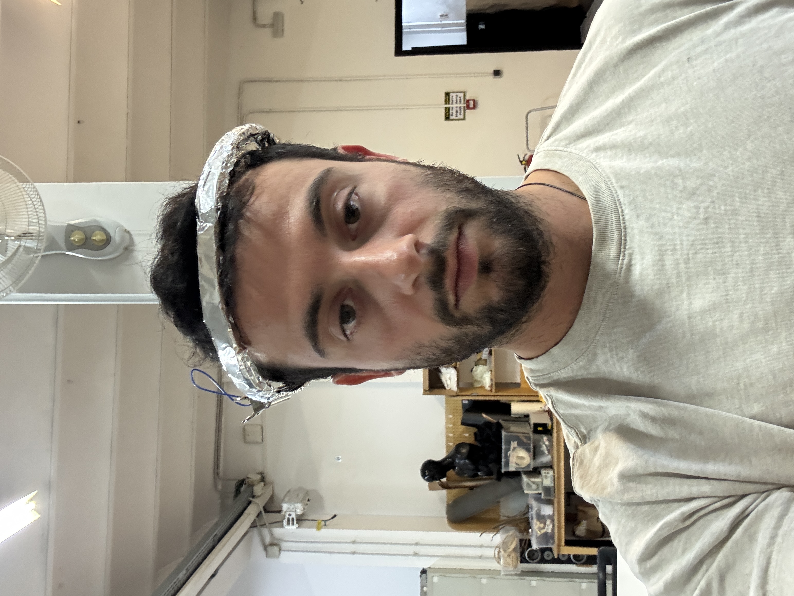 Navigation Band Prosthesis - Front View