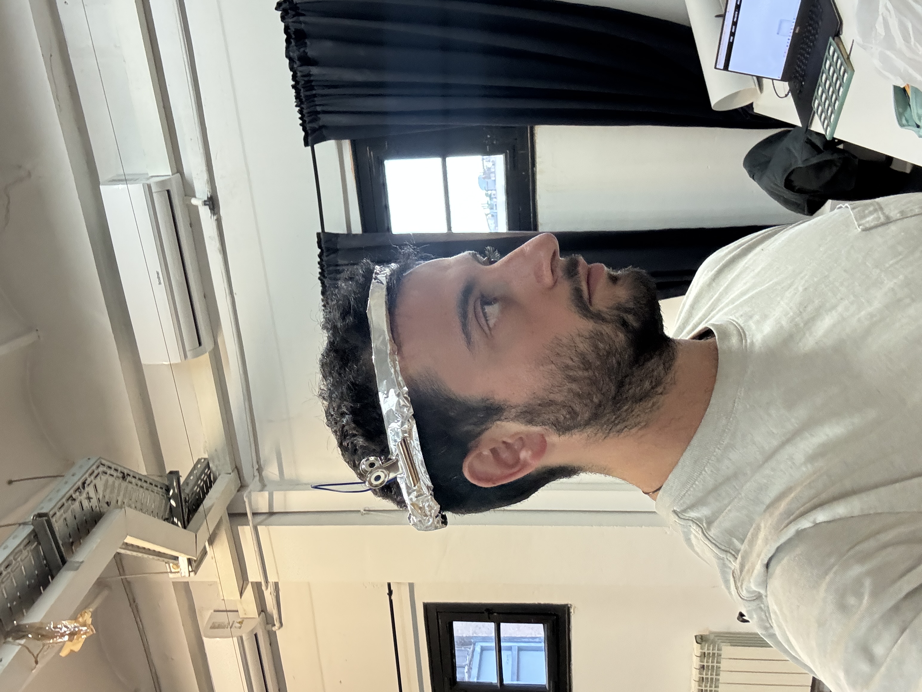 Navigation Band Prosthesis - Side View 1