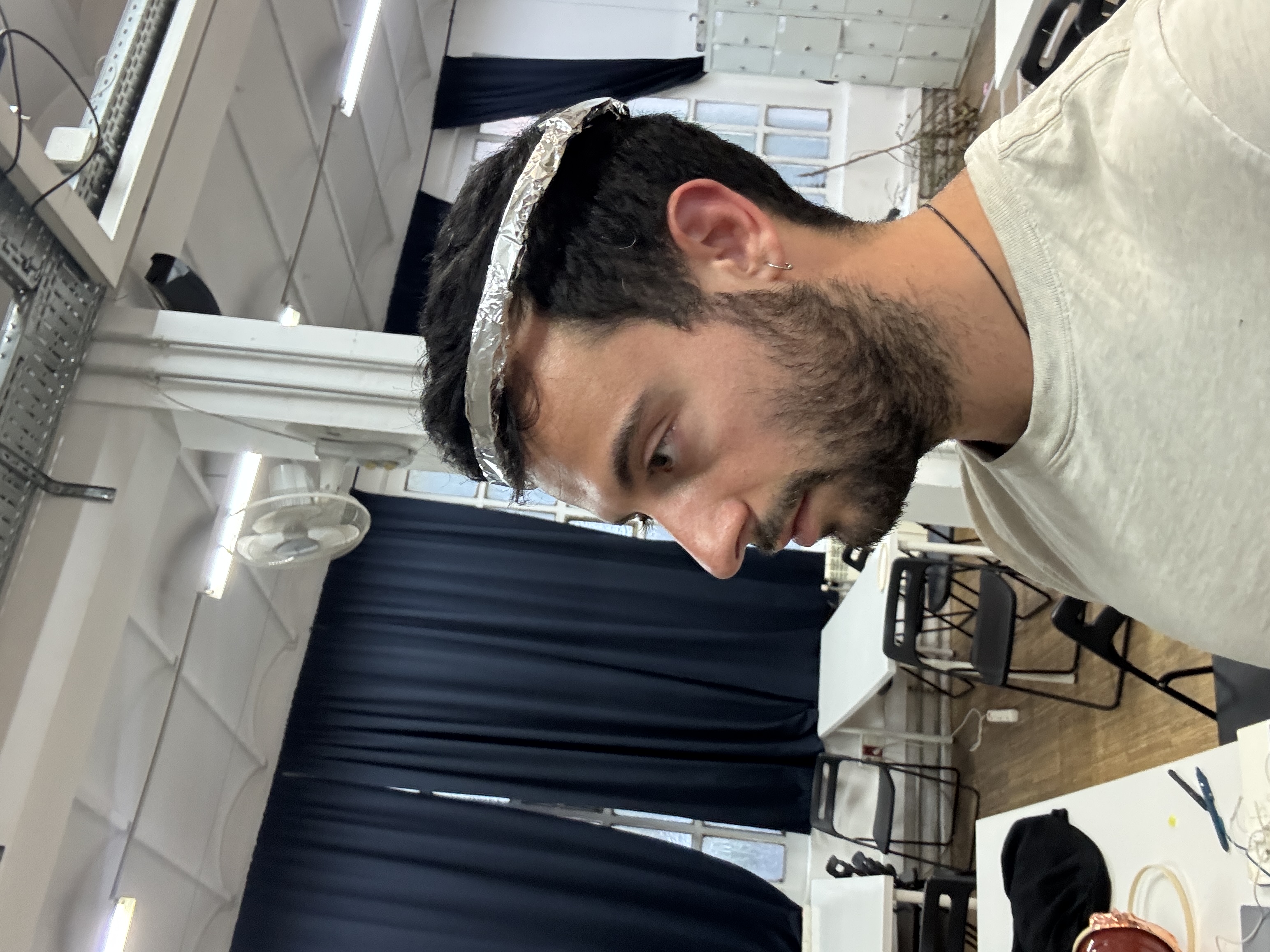 Navigation Band Prosthesis - Side View 2