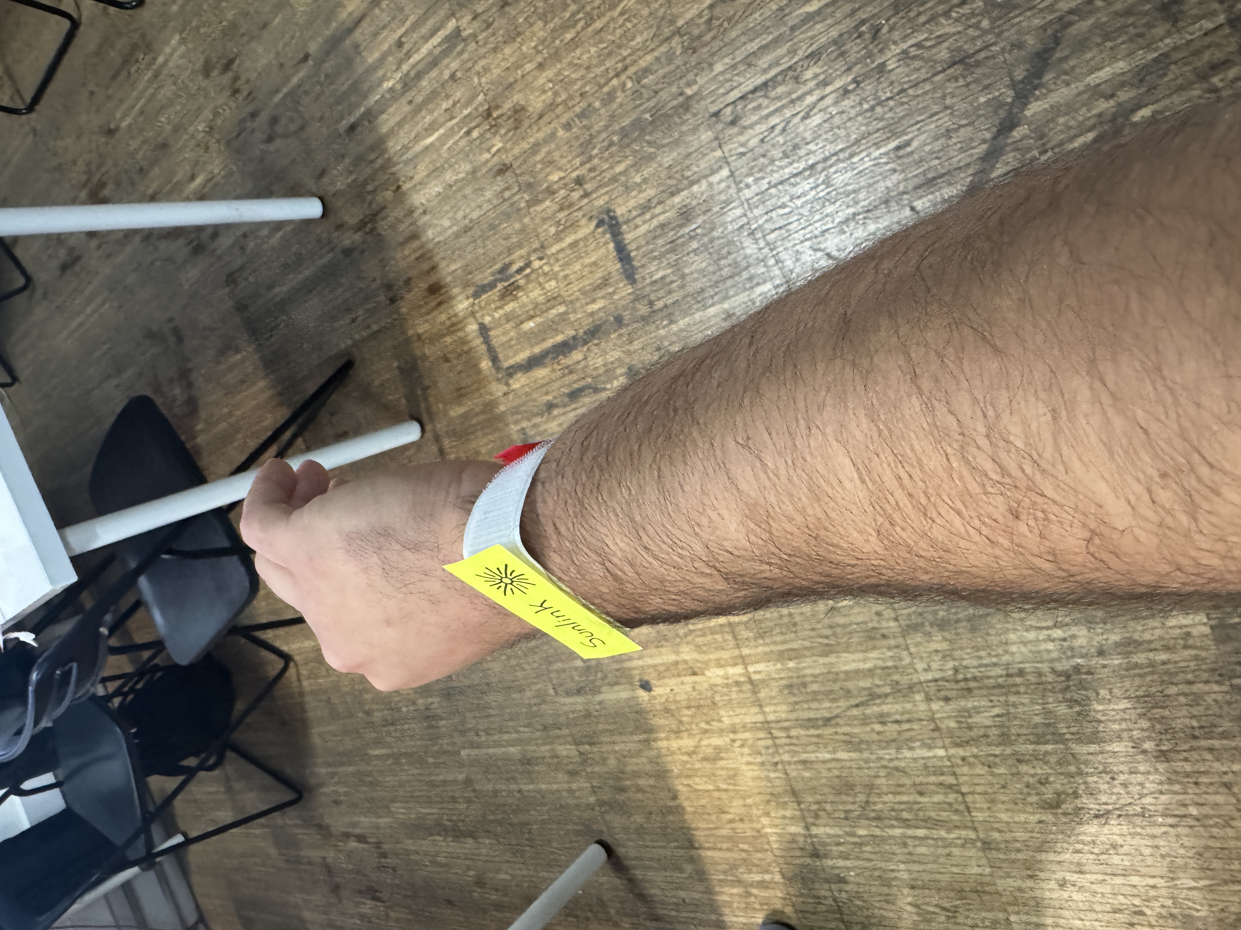 Solarlink Prosthesis - Side View 2